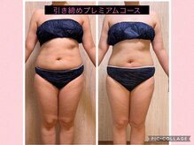 ヨサパーク こらっしぇ御徒町店(YOSA PARK)