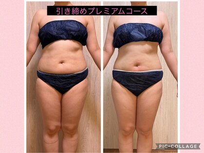 ヨサパーク こらっしぇ御徒町店(YOSA PARK)の写真