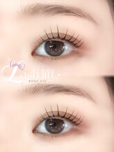 ルーフアイ(ROOF EYE)/ROOF EYE(ルーフ アイ)