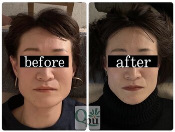 キュープ 富士店(Qpu)/骨格だからと諦めていませんか？