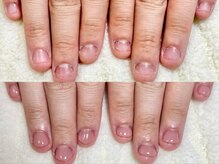 グラシナ なんば店/深爪/自爪育成/フィルイン