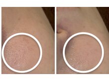 ビビ(VIVI)/毛穴の開きに☆