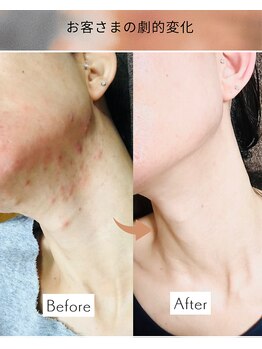 ヨサパーク マヒナ(YOSA PARK Mahina)/Before After