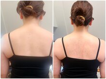 おと(恩智)の雰囲気（丸まった背中もスッキリ。首が長くなり肩甲骨もさっがっています）