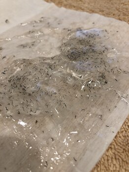 フォーケア(4Care)/メンズひげ脱毛