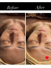 フーレスト アンド フリーリー(Fullest&Freely)/泡洗顔で角質除去