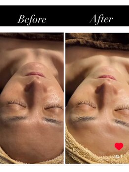 フーレスト アンド フリーリー(Fullest&Freely)/泡洗顔で角質除去