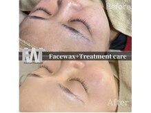 FWTの後は鎮静保湿効果の高いモデリングマスクが必ず付きます♪