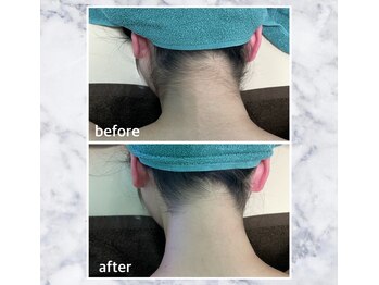 ふわり 別府店(FUWARI)/【レディース】　Before・After