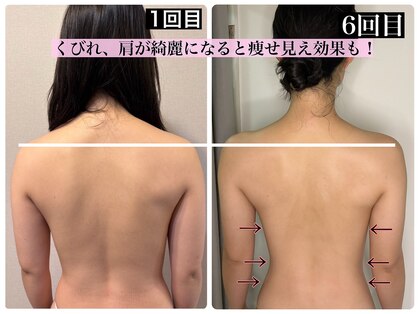 ハーズプラス(hers+)の写真