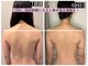 ハーズプラス(hers+)の写真