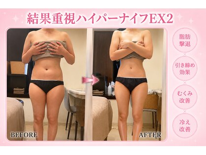 バーリブール 恵比寿店(BERLIBUR)の写真