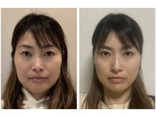 トイボーテ(toi beaute)の雰囲気(一回で激変も♪整う小顔矯正で本来の美しさを取り戻しましょう♪)