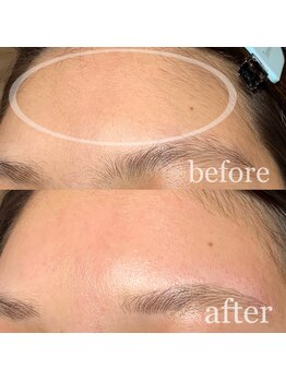 エトレ(ETOLE)/おでこwax