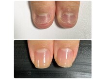 ルカロンネイル(Rukaron Nail)の雰囲気（↑上はご来店時・↓下は3ヶ月後　驚きの変化をぜひご体験下さい）