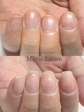 マリーロール 梅田店(Marie Laure)/深爪矯正/自爪育成/自爪風