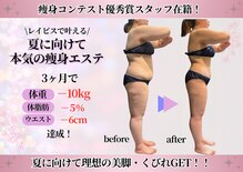 エステティック レイビス 青森店(RAYVIS)