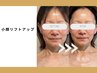 【たるみ・小顔ケア】小顔リフトアップケア