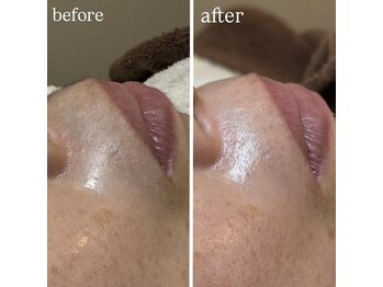 エースマイルイズ(A smile is..)/フェイスワックス