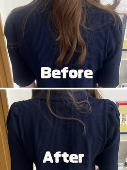 エメ(Eme.)/猫背/巻肩解消でスッキリ!