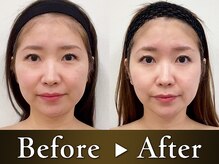 モアビューティー 紙屋町店の雰囲気（【当店イチオシ】肌革命！最新美容機器をぜひお試し下さいませ。）