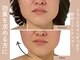 小顔フェイスラボ 難波店(小顔 Face Labo)の写真