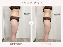 パールプラス 伊勢店(Pearl plus)/通常の痩身と違う、驚きの効果♪