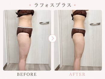 パールプラス 伊勢店(Pearl plus)/通常の痩身と違う、驚きの効果♪