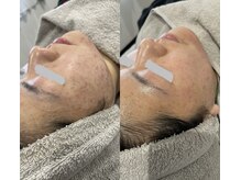 アイアール(ir)/