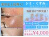 【モニターご案内】シミ改善!ツヤ美肌★ツインエフェクト★新世代スキンケア