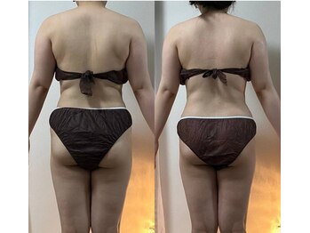 リュミエール(Lumiere)/浮腫みもお肉も脱ぎ捨てて！