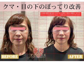 ヴィオーデ 池袋店/小顔、リンパ、ヘッドスパ、骨盤