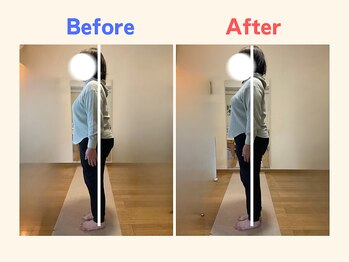 ピース/猫背が気になる60代女性