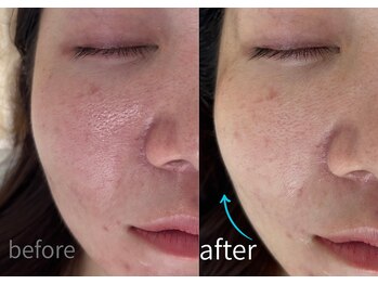 ルーム701(room701)/小顔リフトアップフェイスライン