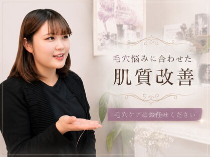 アンヘル(Angel)の写真