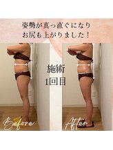 ラルーエ 仙台/全身筋膜痩身90分before→after