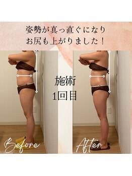 ラルーエ 仙台/全身筋膜痩身90分before→after