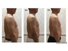 エステサロン ジョアアンジェ(joie ange)/背中コルギで二の腕とお腹まで!