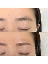 ベル フルール(Bell Fleur)/アイブロウ施術前後