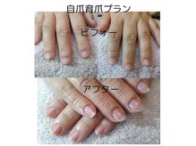 スノー(SNOW)の雰囲気（自爪育成強化中。深爪/割れ爪/小さい爪に悩まれている方に。）