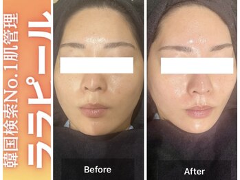 ブレア(Blair)/ララピール