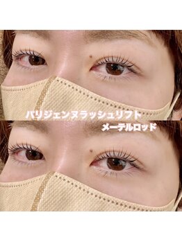 レディエント(Radiant)/パリジェンヌ/メーテルロッド