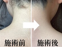 ダイヤモンド(DIAMOND)の雰囲気（事前処理不要！シュガーリングと光脱毛でツルスベ肌が長持ち！）