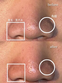 アイビー 長崎店(+i.b)/小鼻ワックス