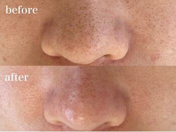 ビエント(VIENTO)/悩んだ時はサロンにお任せ☆