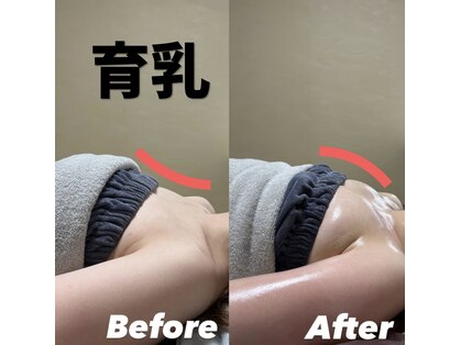 オンユ(Onyu)の写真