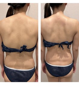 ラセラピー(RaTHERAPY)/ボディの変化