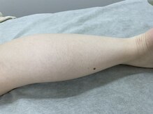 ナノハナ/鹿沼市全身脱毛美容室ナノハナ