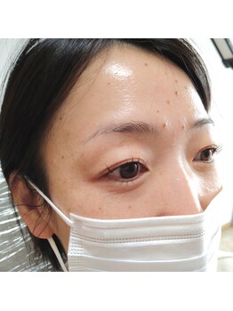 ユニ(uni)/アップフォースリフト♪