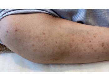 リベル 名古屋(Lebelle:)/ハーブピーリング専門名古屋